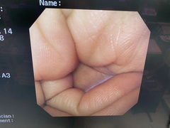 Video Gastroscope｜GIF-XQ240｜Olympus Medical Systems photo6