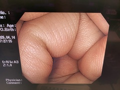 大腸ビデオスコープ｜CF-H260AZI｜オリンパスメディカルシステムズ株式会社の写真6枚目