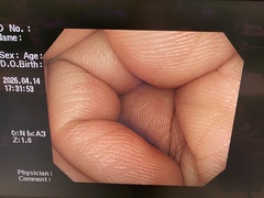 Video Colonoscope｜PCF-Q260AZI｜Olympus Medical Systems photo6