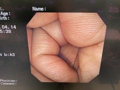 大腸ビデオスコープ｜CF-240AI｜オリンパスメディカルシステムズ株式会社の写真6枚目