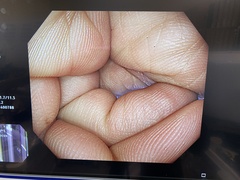 大腸ビデオスコープ｜PCF-H290I｜オリンパスメディカルシステムズ株式会社の写真6枚目