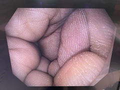 上部消化管汎用ビデオスコープ｜GIF-H190N｜オリンパスメディカルシステムズ株式会社の写真6枚目