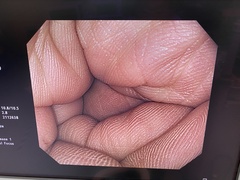 Video Gastroscope｜GIF-H260Z｜Olympus Medical Systems photo6