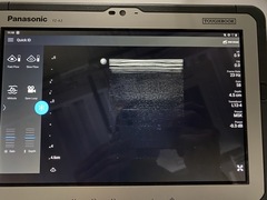 超音波診断装置｜Lumify｜フィリップスの写真6枚目