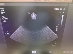 Ultrasound system(Color)｜EPIQ /Affiniti 70G｜Philips photo6