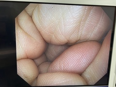 上部消化管用汎用ビデオスコープ｜GIF-XZ1200｜オリンパスメディカルシステムズ株式会社の写真6枚目