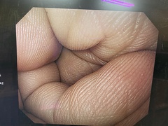 上部消化管汎用ビデオスコープ｜GIF-H260｜オリンパスメディカルシステムズ株式会社の写真6枚目