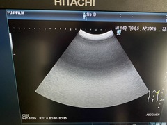 超音波診断装置｜ARIETTA 850｜日立製作所の写真6枚目