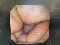 Video Gastroscope｜GIF-XP290N｜Olympus Medical Systems photo6