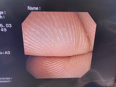 十二指腸ビデオスコープ｜TJF-260V｜オリンパスメディカルシステムズ株式会社の写真6枚目