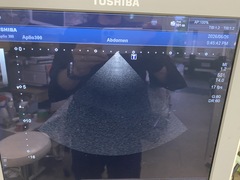 超音波診断装置｜Aplio 300 TUS−A300｜キヤノンメディカルシステムズの写真6枚目