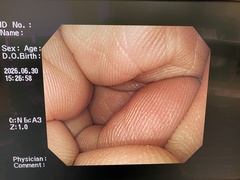 上部消化管汎用ビデオスコープ｜GIF-Q260｜オリンパスメディカルシステムズ株式会社の写真6枚目