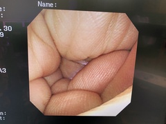 上部消化管汎用ビデオスコープ｜GIF-XP260NS｜オリンパスメディカルシステムズ株式会社の写真6枚目