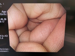 上部消化管汎用ビデオスコープ｜GIF-H260｜オリンパスメディカルシステムズ株式会社の写真6枚目