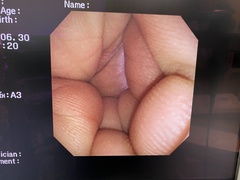 上部消化管汎用ビデオスコープ(径鼻対応)｜GIF-XP260N｜オリンパスメディカルシステムズ株式会社の写真6枚目