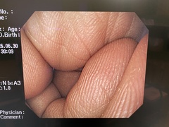 上部消化管汎用ビデオスコープ｜GIF-Q260｜オリンパスメディカルシステムズ株式会社の写真6枚目