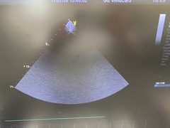 超音波診断装置｜Vivid T8｜GEヘルスケアの写真6枚目