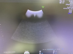 Ultrasound system(Color)｜Voluson E10｜GE Healthcare photo6