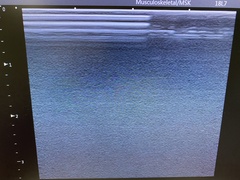 Ultrasound system｜Viamo c100 TUS－VC100｜Canon Medical Systems photo6