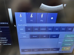 超音波診断装置（カラードプラ）｜LOGIQ P6｜GEヘルスケアの写真6枚目