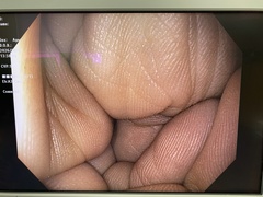上部消化管汎用ビデオスコープ｜GIF-H190N｜オリンパスメディカルシステムズ株式会社の写真6枚目
