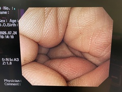 上部消化管汎用ビデオスコープ｜GIF-PQ260｜オリンパスメディカルシステムズ株式会社の写真6枚目