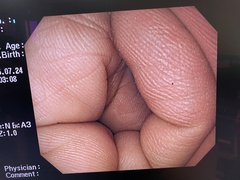 上部消化管汎用ビデオスコープ｜GIF-PQ260｜オリンパスメディカルシステムズ株式会社の写真6枚目