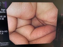 上部消化管汎用ビデオスコープ｜GIF-PQ260｜オリンパスメディカルシステムズ株式会社の写真6枚目