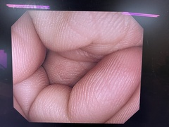 上部消化管汎用ビデオスコープ｜GIF-H260Z｜オリンパスメディカルシステムズ株式会社の写真6枚目