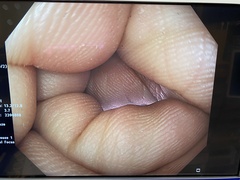 大腸ビデオスコープ｜CF-XZ1200I｜オリンパスメディカルシステムズ株式会社の写真6枚目