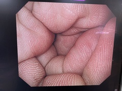 上部消化管汎用ビデオスコープ｜GIF-H260｜オリンパスメディカルシステムズ株式会社の写真6枚目