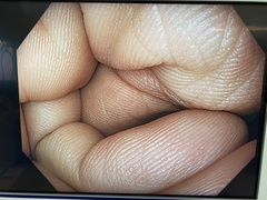 上部消化管汎用ビデオスコープ｜GIF-EZ1500｜オリンパスメディカルシステムズ株式会社の写真6枚目