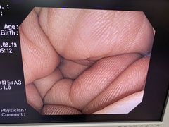 大腸ビデオスコープ｜PCF-PQ260I｜オリンパスメディカルシステムズ株式会社の写真6枚目
