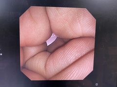 Video Gastroscope｜GIF-XP260｜Olympus Medical Systems photo6
