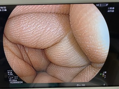 Video Gastroscope｜EG-L590ZW｜Fujifilm Medical photo6