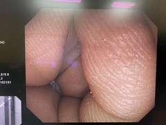 上部消化管汎用ビデオスコープ｜GIF-Q260J｜オリンパスメディカルシステムズ株式会社の写真6枚目