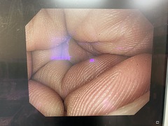 上部消化管汎用ビデオスコープ｜GIF-PQ260｜オリンパスメディカルシステムズ株式会社の写真6枚目