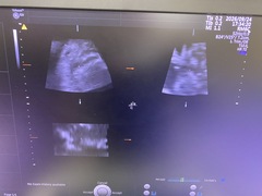 4D超音波診断装置（カラードプラ）｜Voluson E10｜GEヘルスケアの写真6枚目