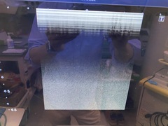 超音波診断装置｜Aplio 300 TUS−A300｜キヤノンメディカルシステムズの写真6枚目