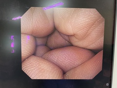 上部消化管汎用ビデオスコープ｜GIF-H260｜オリンパスメディカルシステムズ株式会社の写真6枚目