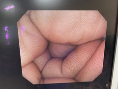 上部消化管汎用ビデオスコープ｜GIF-H260Z｜オリンパスメディカルシステムズ株式会社の写真6枚目