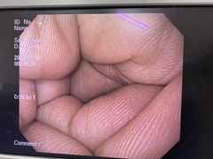 上部消化管汎用ビデオスコープ｜GIF-Q150X｜オリンパスメディカルシステムズ株式会社の写真6枚目