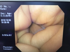 Video Gastroscope｜GIF-SV｜Olympus Medical Systems photo7