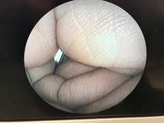 Video Transnasal Gastroscope｜EG-270N5｜Fujifilm Medical photo7