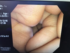 上部消化管汎用ビデオスコープ(径鼻対応)の写真7枚目