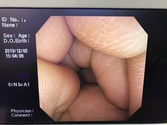 Video Colonoscope｜CF-240I｜Olympus Medical Systems photo7