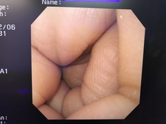 Video Gastroscope｜GIF-SV｜Olympus Medical Systems photo7