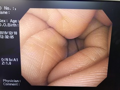 上部消化管汎用ビデオスコープ｜GIF-Q260｜オリンパスメディカルシステムズ株式会社の写真7枚目