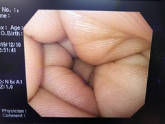 上部消化管汎用ビデオスコープ｜GIF-Q260｜オリンパスメディカルシステムズ株式会社の写真7枚目