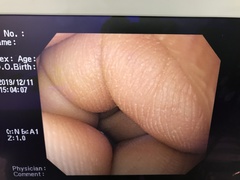 上部消化管汎用ビデオスコープ｜GIF-PQ260｜オリンパスメディカルシステムズ株式会社の写真7枚目